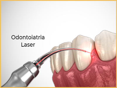 Dentista Laser Turchia