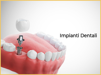 impianti dentali turchia